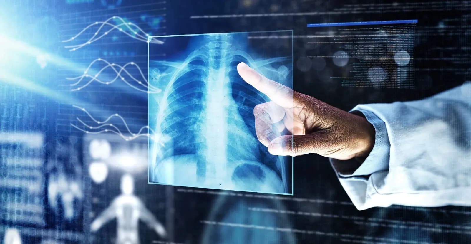 The Role of AI in Enhancing RPM
