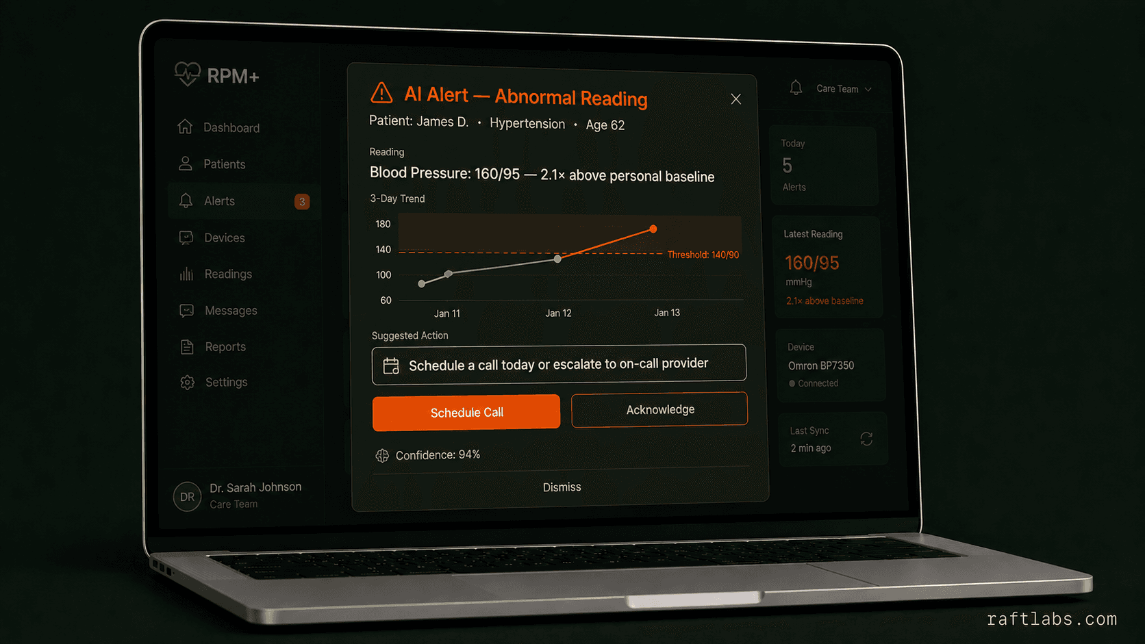 AI abnormality detection