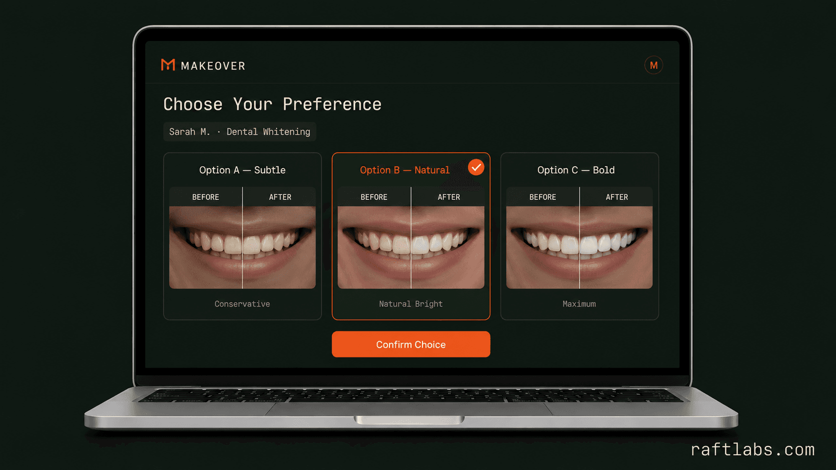 Makeover multi-variation screen showing three treatment options side by side for the same client with the middle option selected